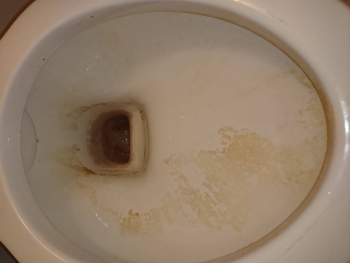 クリーニング前の便器1